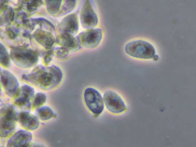 Botryobasidium con spore finemente verrucose
